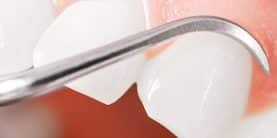 periodoncia miniatura