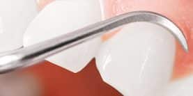 periodoncia miniatura